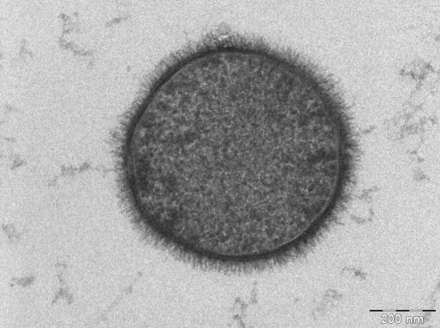 Differential effects of Bacillus subtilis- and Bacillus licheniformis-fermented products on growth performance, intestinal morphology, intestinal antioxidant and barrier function gene expression, cecal microbiota community, and microbial carbohydrate-active enzyme composition in broilers