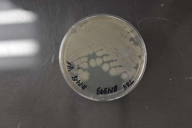 Understanding the Role of⁢ Bacillus‍ amyloliquifaciens in Camel Milk‌ for Neuroinflammatory​ Suppression