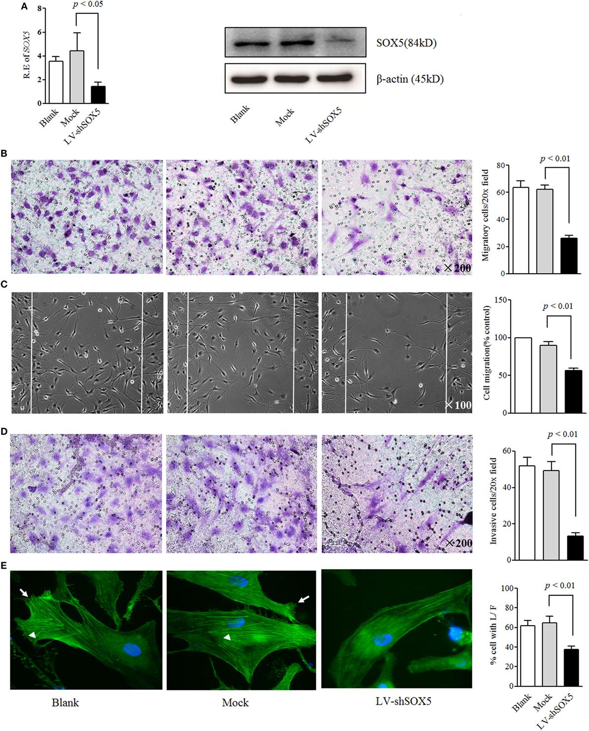 The Role of SOX5/miR-218 Axis ⁢in⁤ Neuroprotective Mechanisms